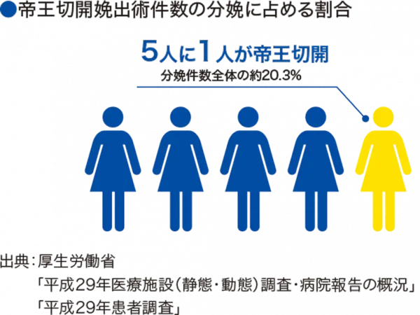 帝王切開割合説明図